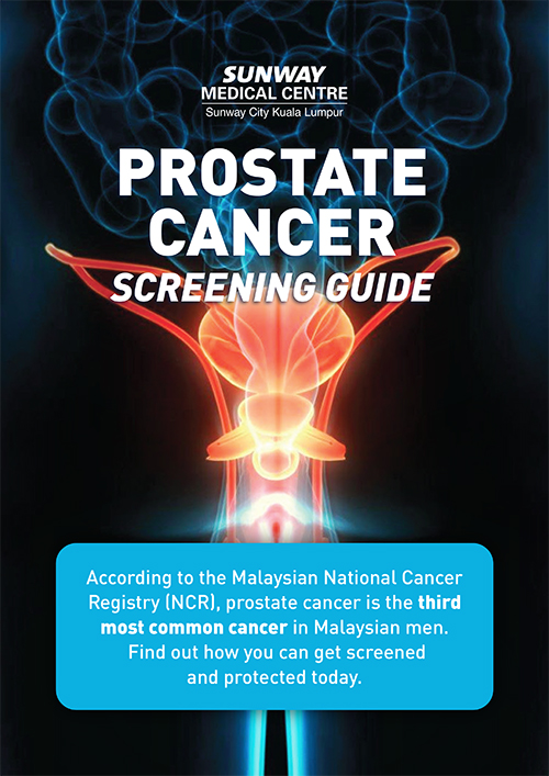 Prostate Cancer Screening Guidelines handbook